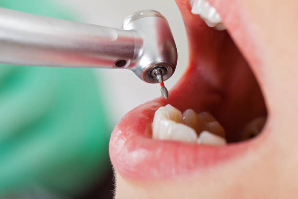 Best Emergency Care for Gum Disease in Muscle Shos, AL